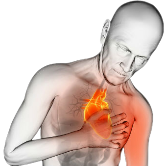 Imagen riesgo cardiovascular ATCAL